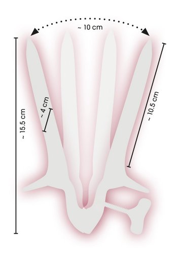 Vaginal Speculum